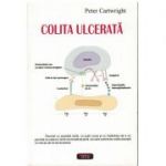 Colita ulcerata – Peter Cartwright